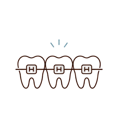 Metal Braces