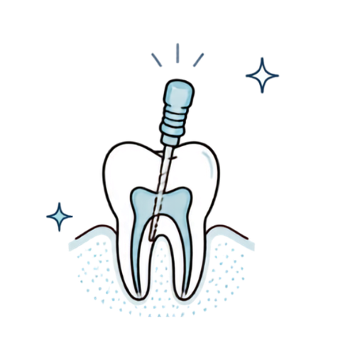Re-Root Canal