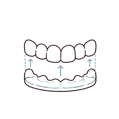 Retainers