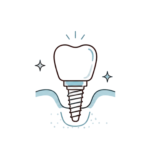 Single Tooth Implants