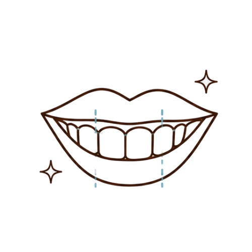 Smile Designing